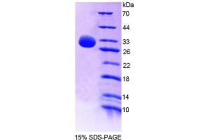 SDS-PAGE analysis of Rat SHP Protein. (NR0B2 Protéine)