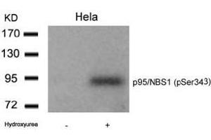 Image no. 1 for anti-Nibrin (NBN) (pSer343) antibody (ABIN196715) (Nibrin anticorps  (pSer343))