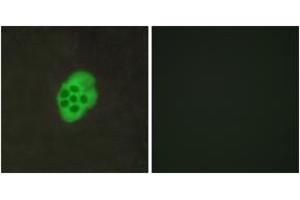 Immunofluorescence analysis of MCF7 cells, using HTR4 Antibody. (Serotonin Receptor 4 anticorps  (AA 141-190))