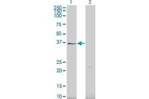 Western Blot analysis of HEY1 expression in transfected 293T cell line by HEY1 monoclonal antibody (M02), clone 2F10. (HEY1 anticorps  (AA 121-220))
