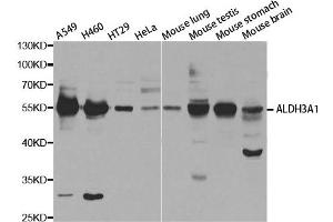 Western Blotting (WB) image for anti-Aldehyde Dehydrogenase 3 Family, Member A1 (ALDH3A1) antibody (ABIN1876688)
