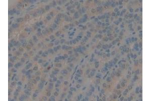 DAB staining on IHC-P; Samples: Human Thyroid Tissue (GDF10 anticorps  (AA 337-477))