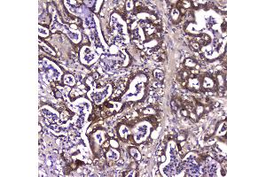 IHC analysis of GDA using anti-GDA antibody .