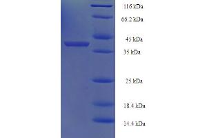 SDS-PAGE (SDS) image for NQO2 (NQO2) (AA 1-231), (full length) protein (His-SUMO Tag) (ABIN5711399)
