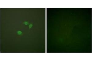 Immunofluorescence analysis of NIH-3T3 cells, using Sumo1 Antibody.