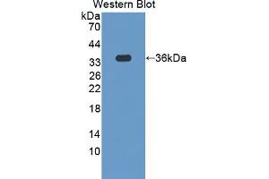 Detection of Recombinant SCGN, Human using Polyclonal Antibody to Secretagogin (SCGN)