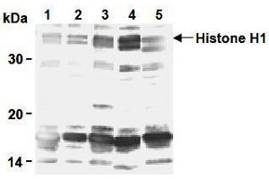 Western Blotting (WB) image for anti-H1 Histone Family, Member 0 (H1F0) antibody (ABIN1449237) (Histone H1 anticorps)