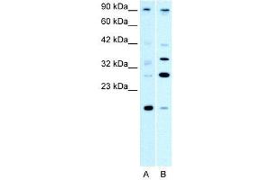 WB Suggested Anti-PARP11  Antibody Titration: 0. (PARP11 anticorps  (N-Term))