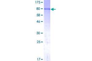 Image no. 1 for Alkaline Phosphatase, Liver/bone/kidney (ALPL) (AA 1-524) protein (GST tag) (ABIN1344937)