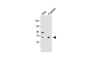 All lanes : Anti-ALOX12 Antibody (C-term) at 1:1000 dilution Lane 1: Hela whole cell lysate Lane 2: Rat spleen whole tissue lysate Lysates/proteins at 20 μg per lane. (ALOX12 anticorps  (C-Term))