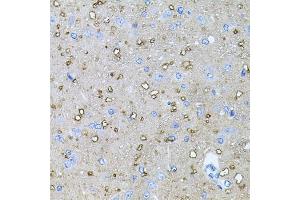 Immunohistochemistry of paraffin-embedded rat brain using NTF4 antibody (ABIN5970439) at dilution of 1/100 (40x lens).