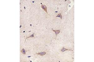 Immunohistochemical analysis of paraffin-embedded H. (Tuberin anticorps  (AA 1397-1426))