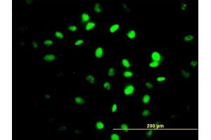 Immunofluorescence of monoclonal antibody to ZNF24 on HeLa cell. (ZNF24 anticorps  (AA 1-368))