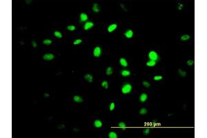 Immunofluorescence of monoclonal antibody to ZNF24 on HeLa cell. (ZNF24 anticorps  (AA 1-368))
