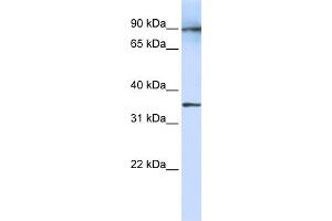 WB Suggested Anti-LRRC59 Antibody Titration:  1 ug/ml  Positive Control:  Fetal Lung cell lysate (LRRC59 anticorps  (N-Term))