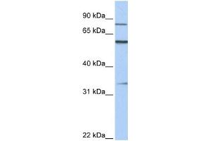 WB Suggested Anti-ZNF16 Antibody Titration:  0. (ZNF16 anticorps  (C-Term))