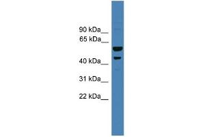 WB Suggested Anti-SERPINB2 Antibody Titration: 0. (SERPINB2 anticorps  (Middle Region))