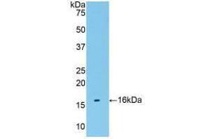 Western blot analysis of recombinant Human TMEM27. (TMEM27 anticorps  (AA 17-137))