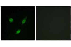 Immunofluorescence analysis of MCF-7 cells, using TACC1 antibody.