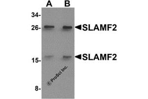 Western Blotting (WB) image for anti-CD48 (CD48) (Middle Region) antibody (ABIN1031096) (CD48 anticorps  (Middle Region))