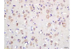 Formalin-fixed and paraffin embedded rat brain labeled with Rabbit Anti-TSPAN12 Polyclonal Antibody, Unconjugated (ABIN2179830) at 1:200 followed by conjugation to the secondary antibody and DAB staining (TSPAN12 anticorps  (AA 1-100))