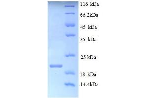 SDS-PAGE (SDS) image for Potassium Voltage-Gated Channel, Shaker-Related Subfamily, Member 1 (KCNA1) (AA 1-154), (partial) protein (His tag) (ABIN5709785)
