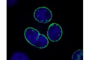 Immunofluorescence (IF) image for anti-Nucleoprotein TPR (TPR) (C-Term) antibody (ABIN7448922) (TPR anticorps  (C-Term))
