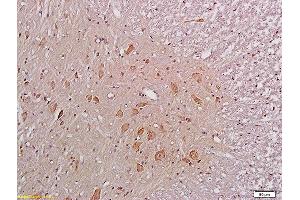 Formalin-fixed and paraffin embedded rat spinal cord labeled with Anti-NR1/NMDAR1 Polyclonal Antibody, Unconjugated (ABIN678338) at 1:200 followed by conjugation to the secondary antibody and DAB staining