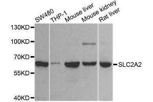 Western blot analysis of extracts of various cell lines, using SLC2A2 antibody (ABIN6003575) at 1/1000 dilution. (SLC2A2 anticorps)
