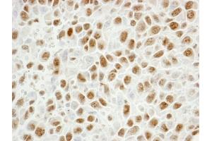 Immunohistochemistry (IHC) image for anti-Proliferating Cell Nuclear Antigen (PCNA) (C-Term) antibody (ABIN7448997) (PCNA anticorps  (C-Term))