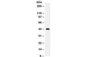 Western blot testing of human 22RV1 cell lysate with WNT2B antibody.
