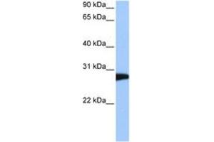 Image no. 1 for anti-N-Ethylmaleimide-Sensitive Factor (NSF) (AA 662-711) antibody (ABIN6744481) (NSF anticorps  (AA 662-711))