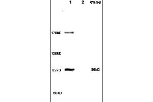 Formalin-fixed and paraffin embedded rat brain tissue labeled with Anti PHLP Polyclonal Antibody,Unconjugated (ABIN715121) at 1:200 followed by conjugation to the secondary antibody and DAB staining.