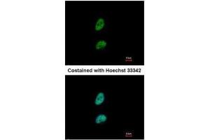 ICC/IF Image Immunofluorescence analysis of paraformaldehyde-fixed HeLa, using PSME3, antibody at 1:500 dilution. (PSME3 anticorps)