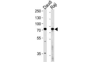 Western Blotting (WB) image for anti-Germ Cell Associated 2 (Haspin) (GSG2) antibody (ABIN3003656) (GSG2 anticorps)
