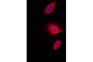 ABIN6257707 and ABIN6274332 staining Hela by IF/ICC. (CHAF1A anticorps  (N-Term))