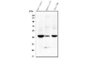 Western blot analysis of TMEM255B using anti-TMEM255B antibody (ABIN7600444). (TMEM255B anticorps  (AA 196-240))