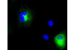 Image no. 3 for anti-Amyloid beta (A4) Precursor Protein (APP) antibody (ABIN1496880) (APP anticorps)