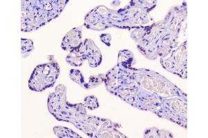 IHC analysis of AES using anti-AES antibody (ABIN6719264). (AES anticorps  (AA 69-138))