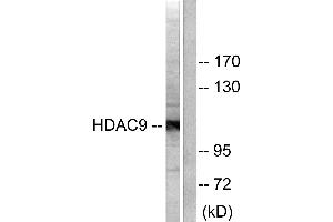 Western blot analysis of extracts from HepG2 cells, using HDAC9 antibody (#C0228). (HDAC9 anticorps)