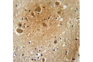 Immunohistochemistry analysis in human brain tissue (Formalin-fixed, Paraffin-embedded) using SPARCL1 / Hevin  Antibody , followed by peroxidase conjugation of the secondary antibody and DAB staining. (SPARCL1 anticorps  (Middle Region))