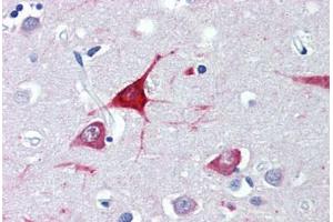 Brain, cortex, Human: Formalin-Fixed, Paraffin-Embedded (FFPE) (USP9X anticorps  (AA 2479-2492))