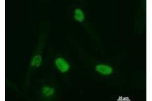 Immunostaining analysis in HeLa cells.