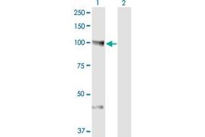 Western Blot analysis of NEDD9 expression in transfected 293T cell line by NEDD9 monoclonal antibody (M01A), clone 1B4. (NEDD9 anticorps  (AA 101-200))