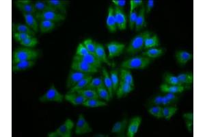 Immunofluorescence staining of HepG2 cells with ABIN7163038 at 1:133, counter-stained with DAPI. (BFSP2 anticorps  (AA 11-110))
