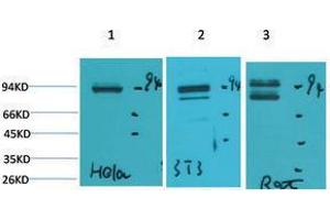 Western Blotting (WB) image for anti-Signal Transducer and Activator of Transcription 1, 91kDa (STAT1) antibody (ABIN3179107) (STAT1 anticorps)