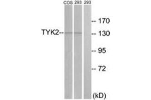 Western blot analysis of extracts from 293/COS7 cells, treated with heat shock, using TYK2 (Ab-1054) Antibody. (TYK2 anticorps  (AA 1020-1069))