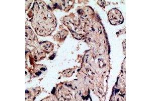 Immunohistochemical analysis of Endothelin B Receptor staining in human placenta formalin fixed paraffin embedded tissue section.