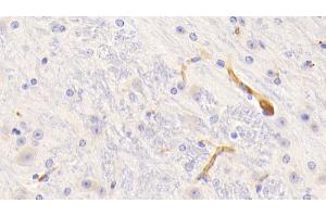 Detection of FGg in Mouse Cerebrum Tissue using Polyclonal Antibody to Fibrinogen Gamma (FGg) (FGG anticorps  (AA 168-405))