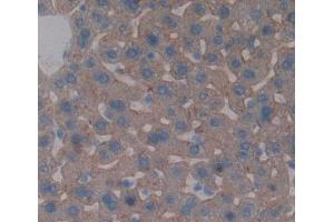 Used in DAB staining on fromalin fixed paraffin- embedded liver tissue (ABCB4 anticorps  (AA 1034-1276))